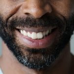 tooth bonding rockville