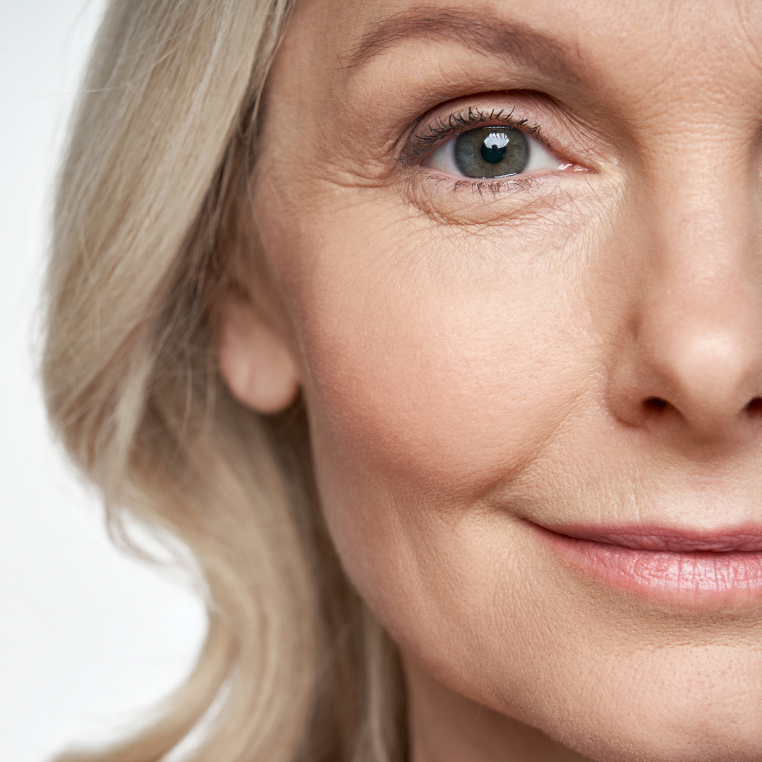 non-surgical face lift Virginia