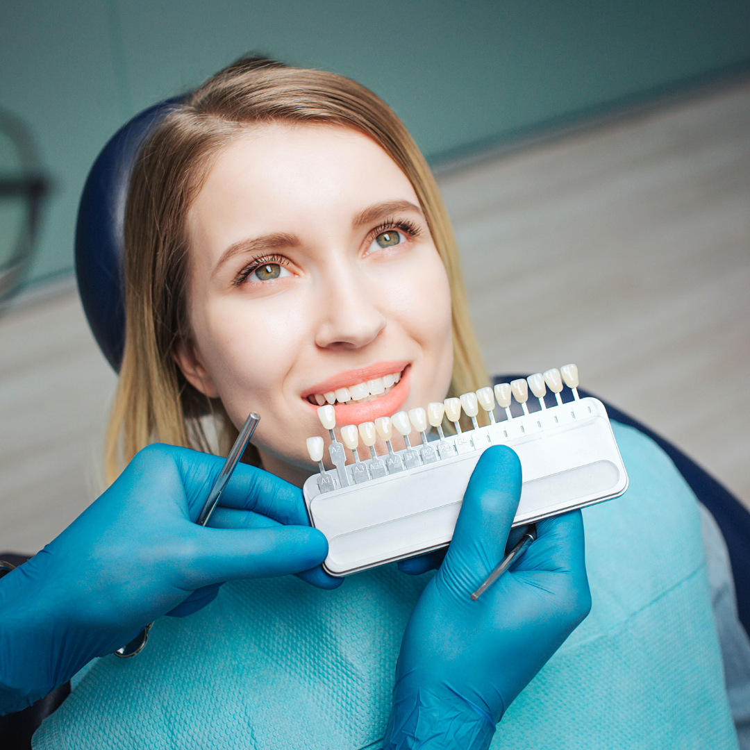 Dental Veneers