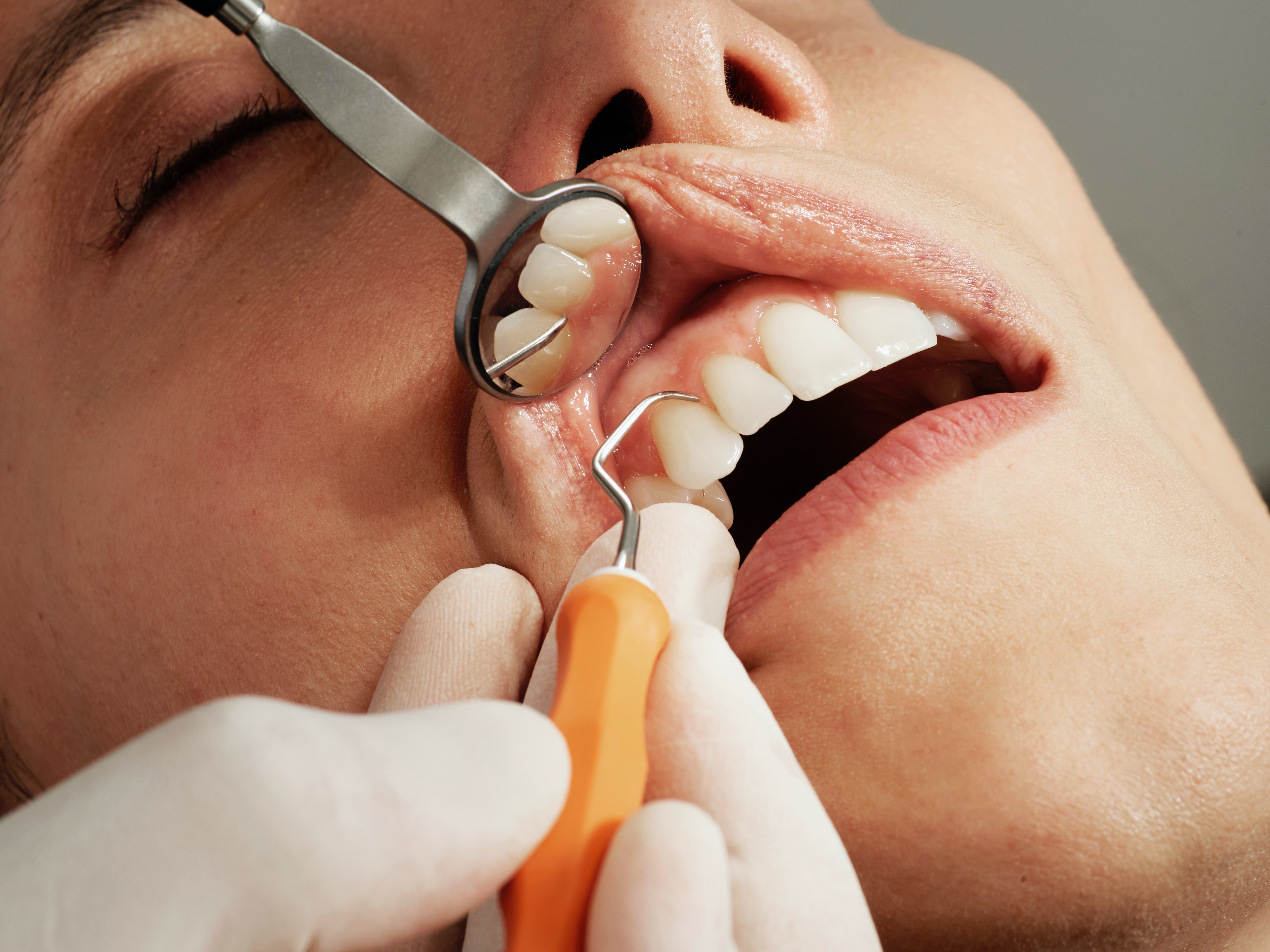 cosmetic dentist rockville