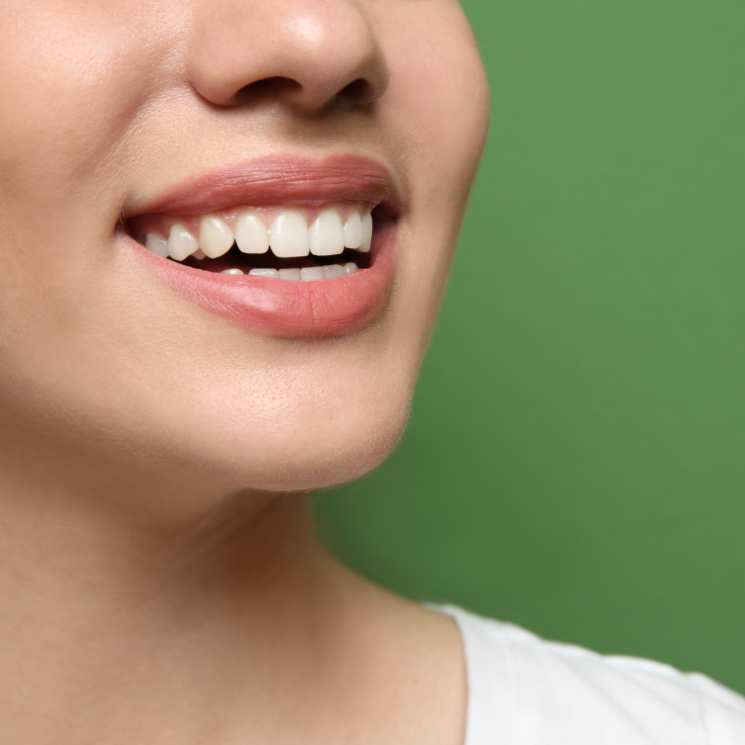 dental implants rockville