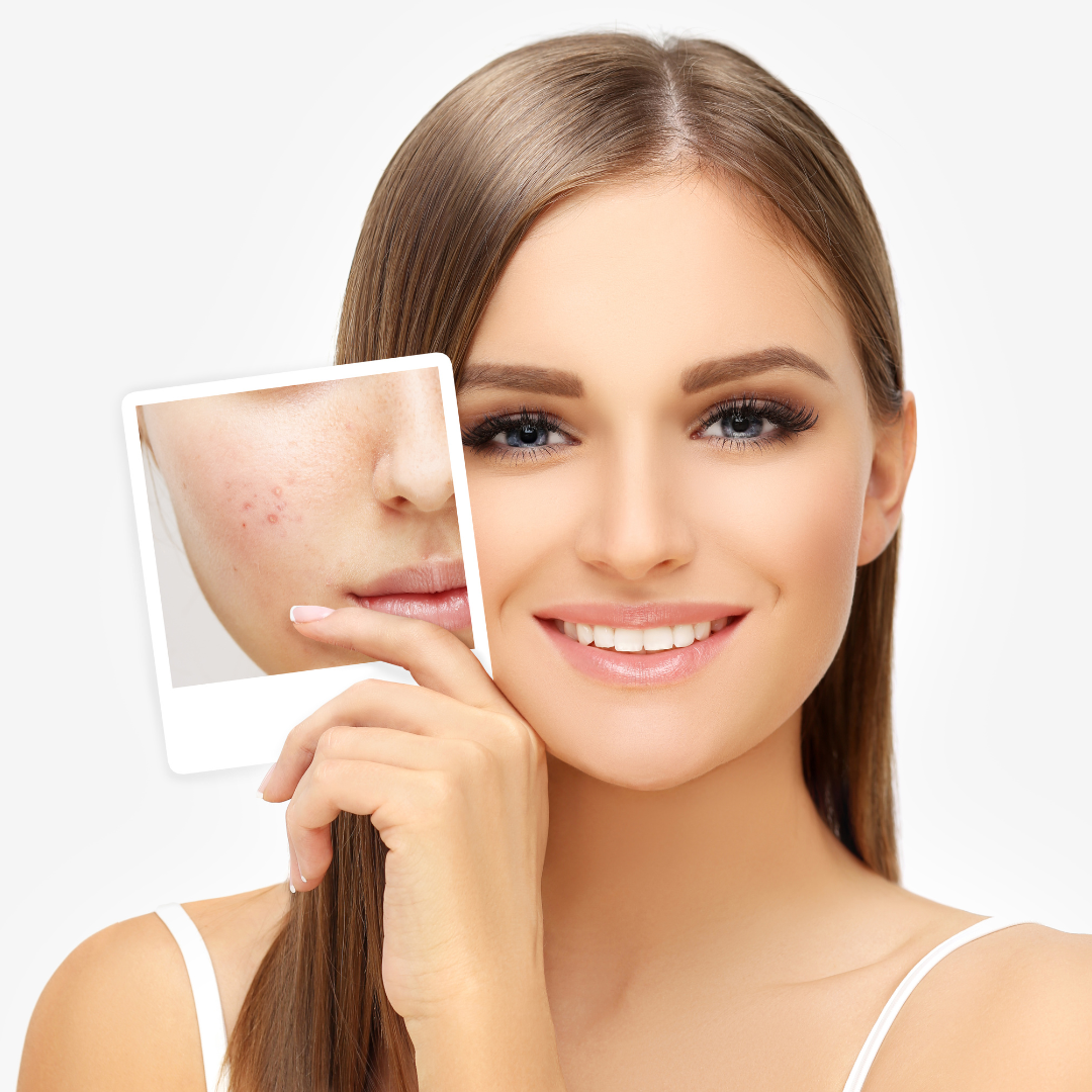benefits of IPL rockville