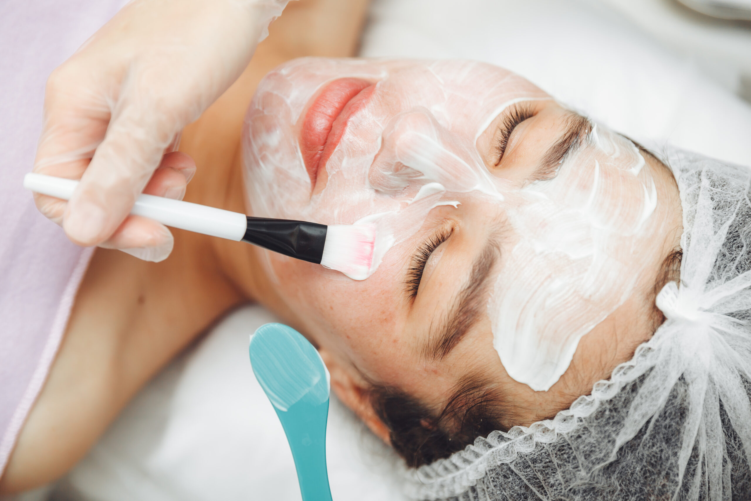 Best Facials For Acne in Maryland