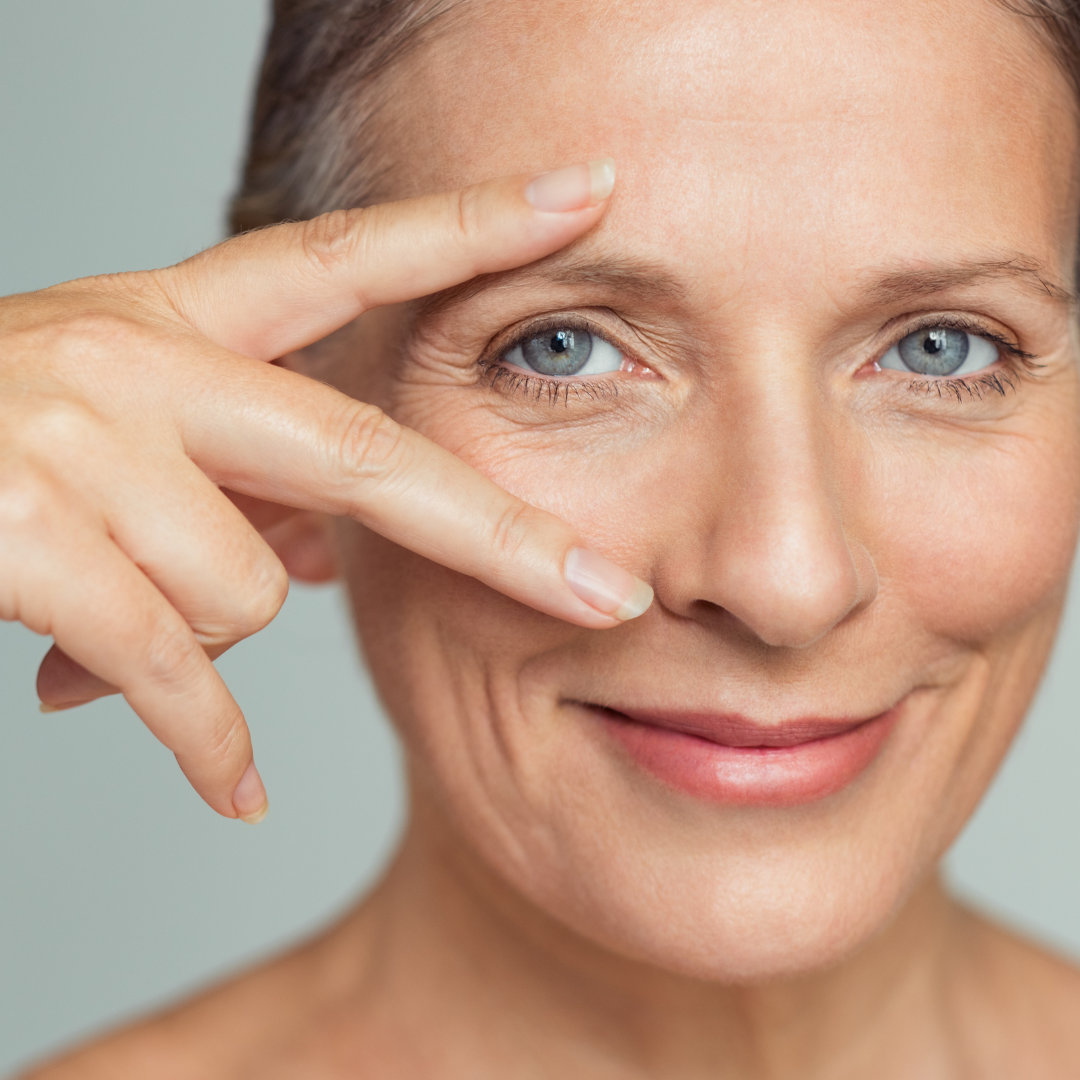 dermal filler for eye bags