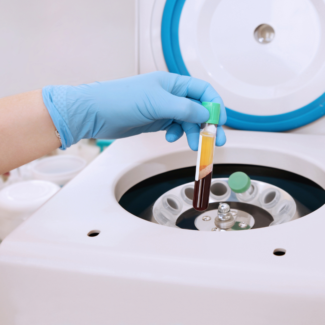 PRP Skin Rejuvenation in Rockville