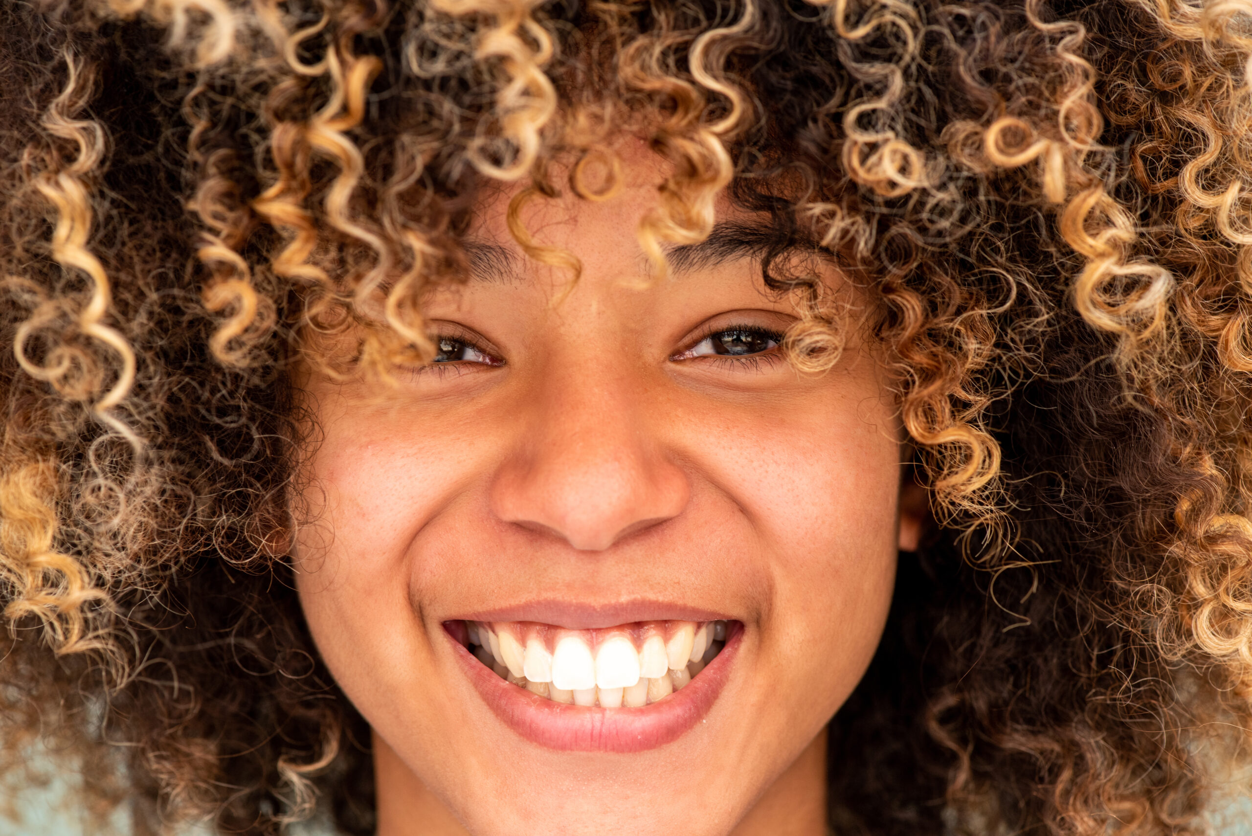 smile makeover cost Rockville Maryland