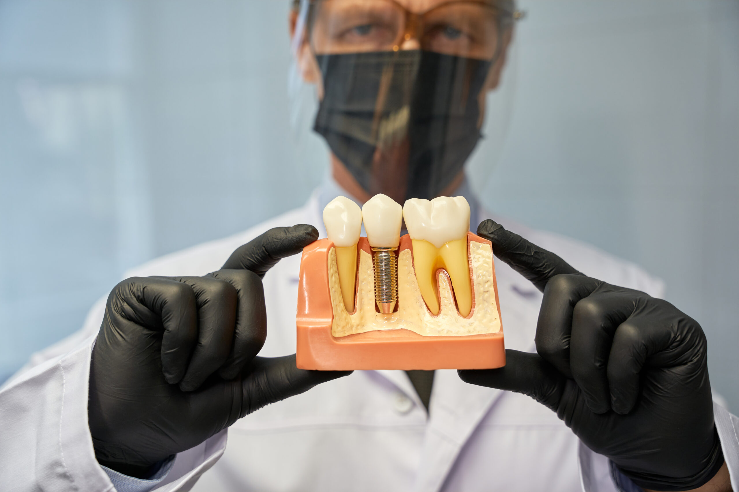 Cost of Dental Implants Bethesda MD