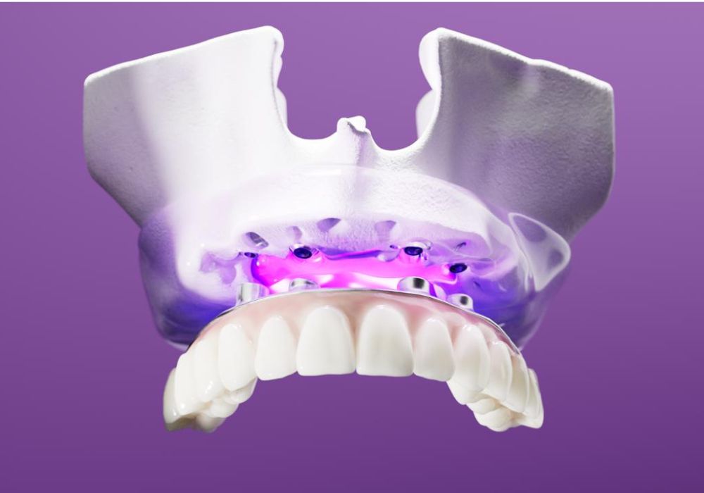 From Dentures to Dental Implants: What To Know