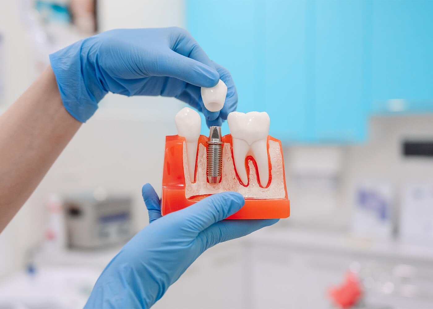 restorative dentistry services