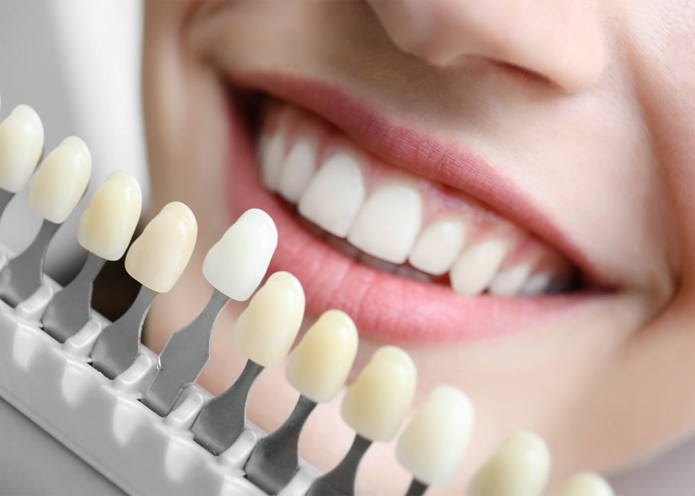 cosmetic dentistry services