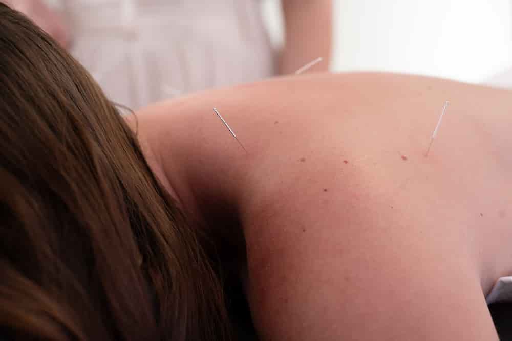 Discover how acupuncture may help support your body during periods of stress. Learn how treatment can promote relaxation, ease tension, improve sleep, and support overall wellbeing.