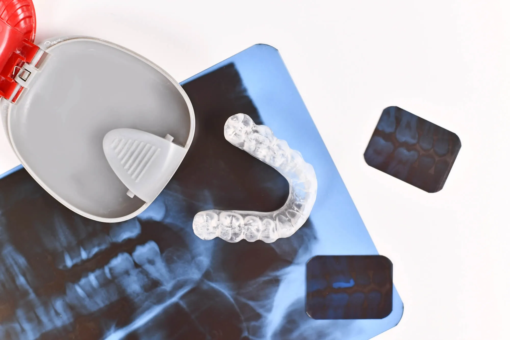 angel aligners birmingham and Xrays