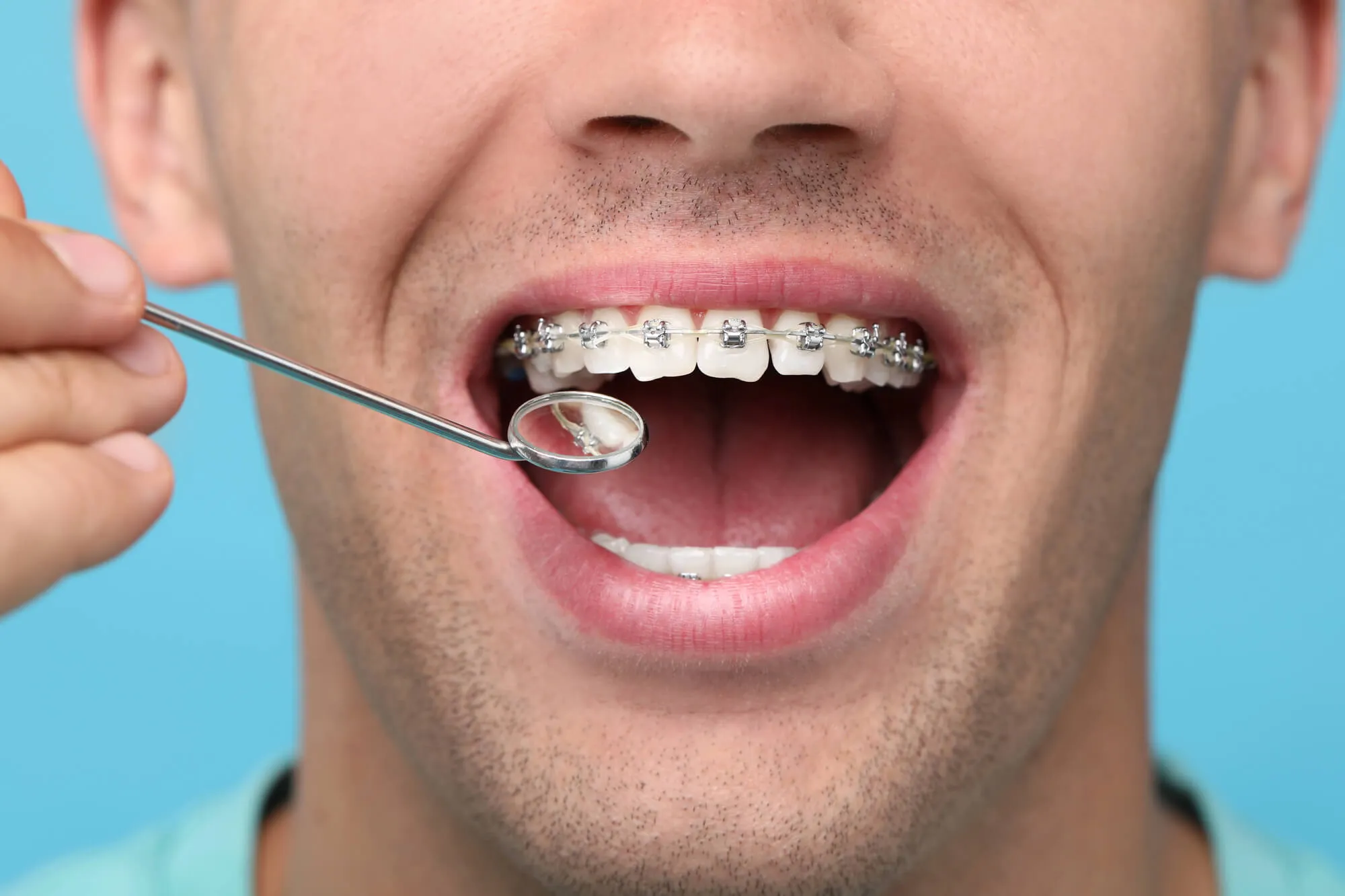 man wearing metal braces birmingham