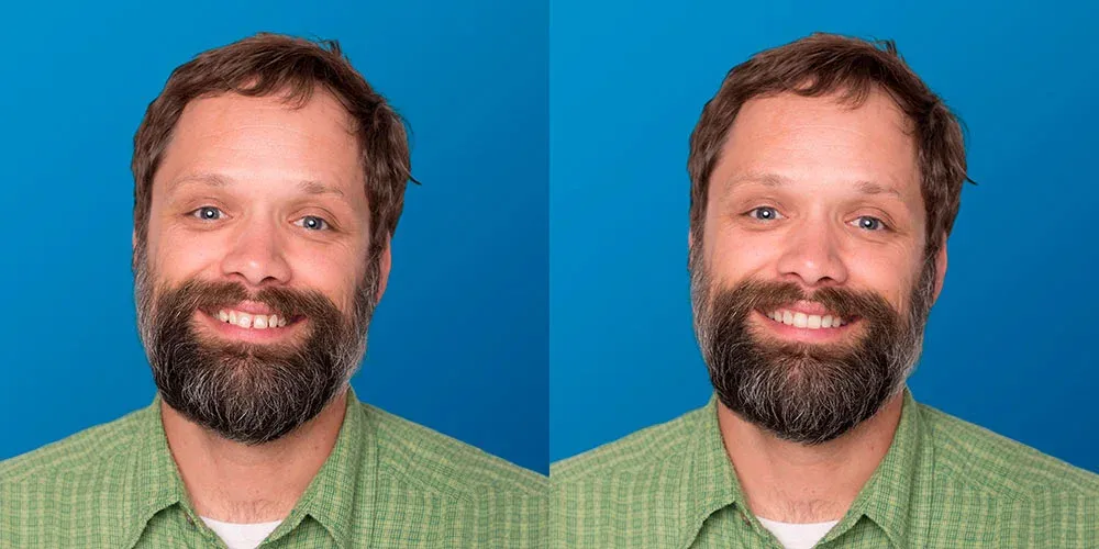 Side-by-side comparison of a man with a beard and green shirt, showing a before and after teeth whitening effect with a brighter smile on the right.