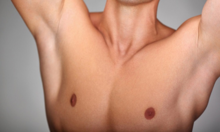 Gynecomastia Miami