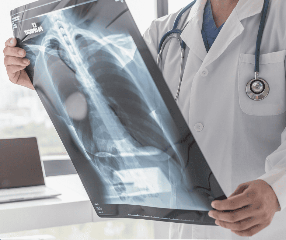 X-ray image of the lungs