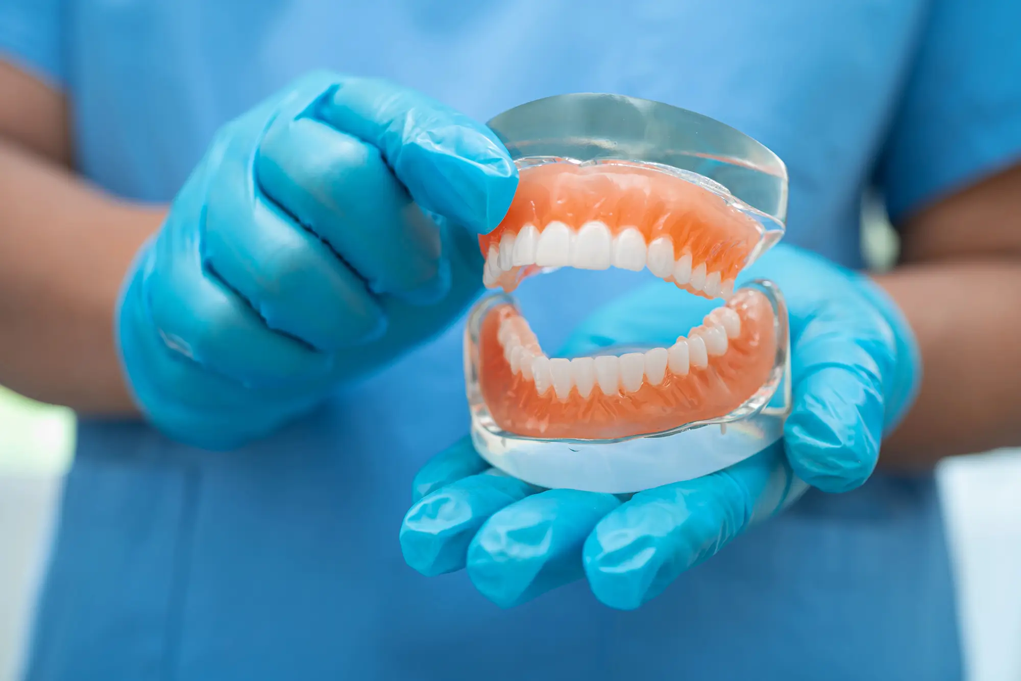 Dental Implant Model in Montgomery AL