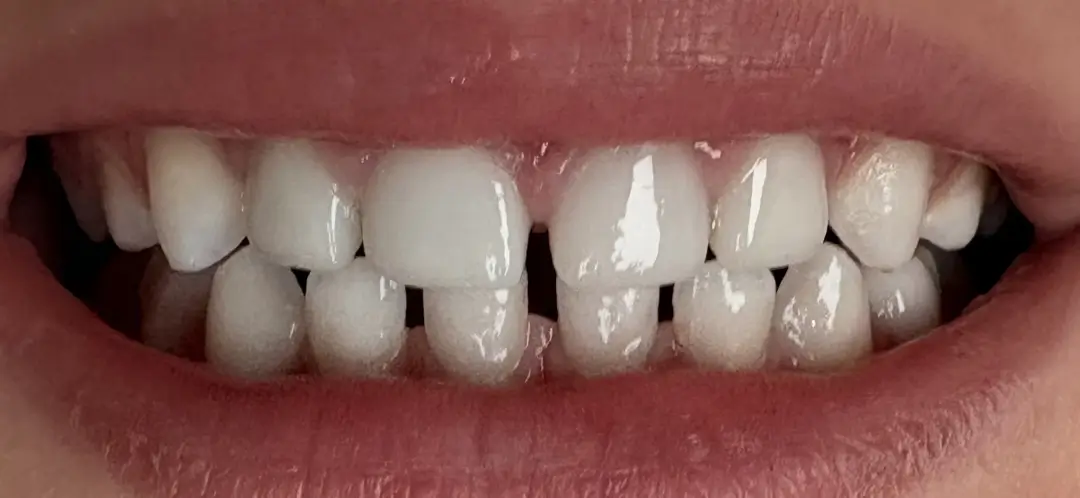 After Image