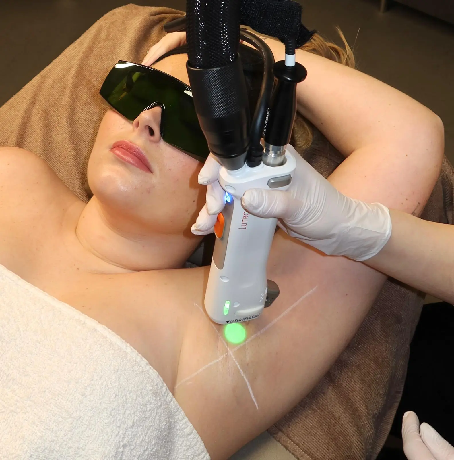 LASERONTHARING 5 + 2