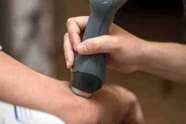 A therapist is treating a patient's elbow with a cold laser.