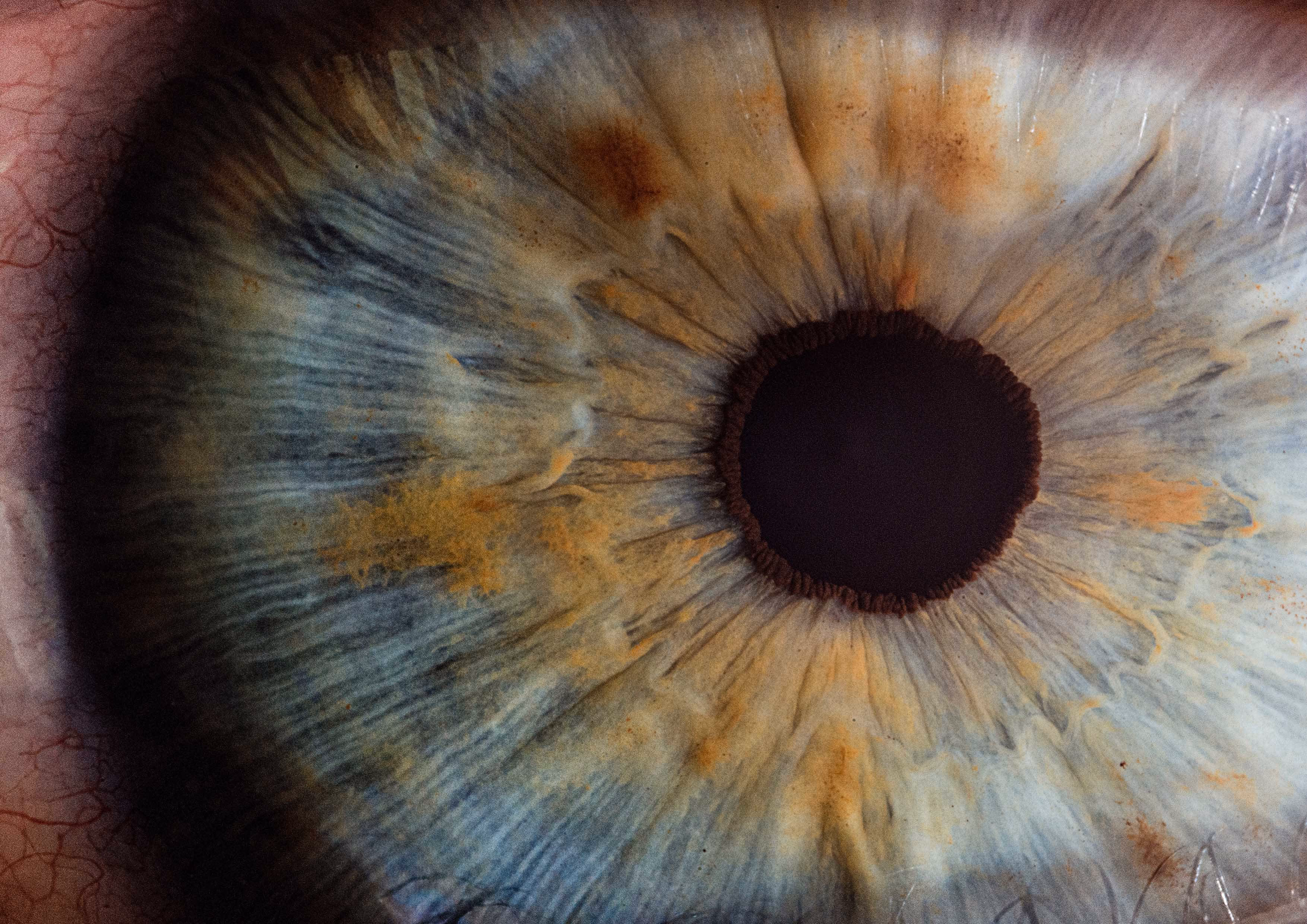 Séance d'EMDR, retraitement des souvenirs par stimulations alternées