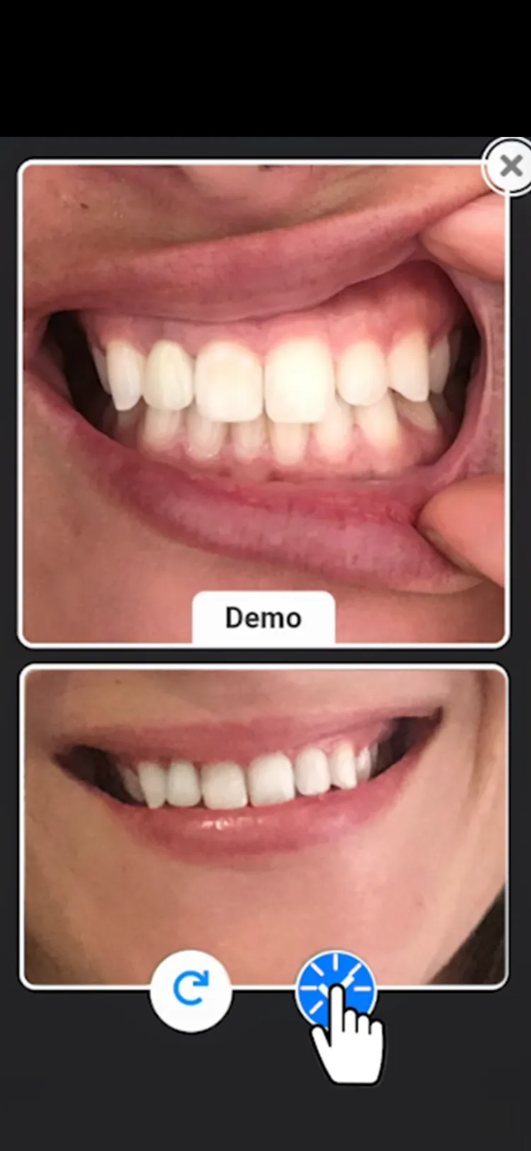 Dental close up image