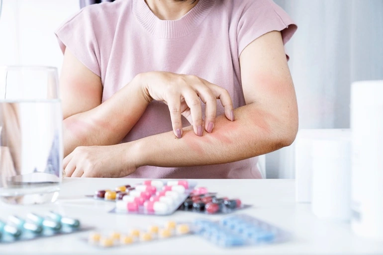 Adverse Drug Reactions