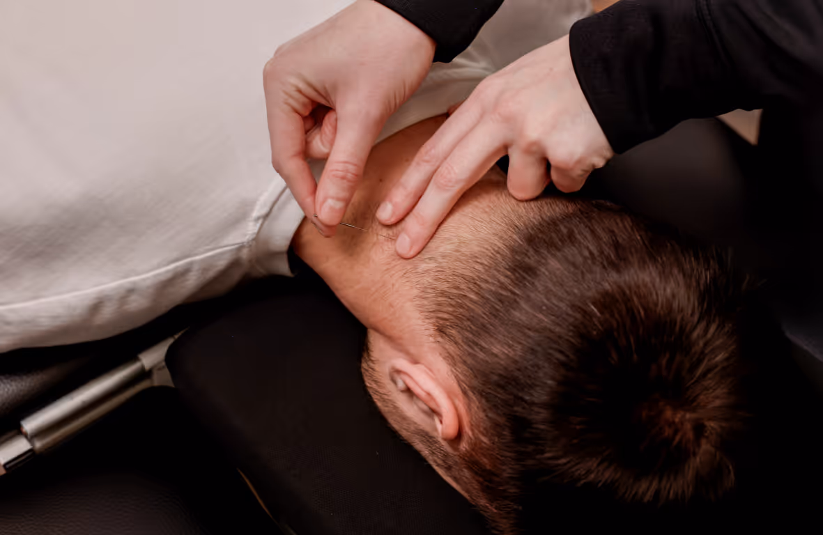 Dry needling nek: zo raak je die stijve nek kwijt zonder medicatie