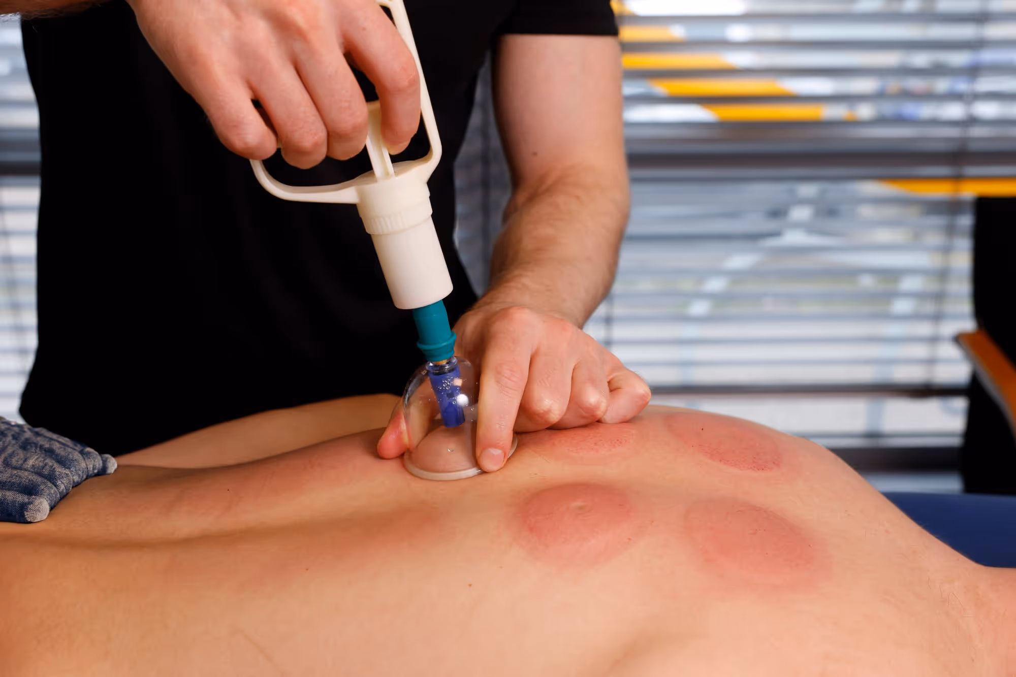 Wat houdt fasciatherapie in?