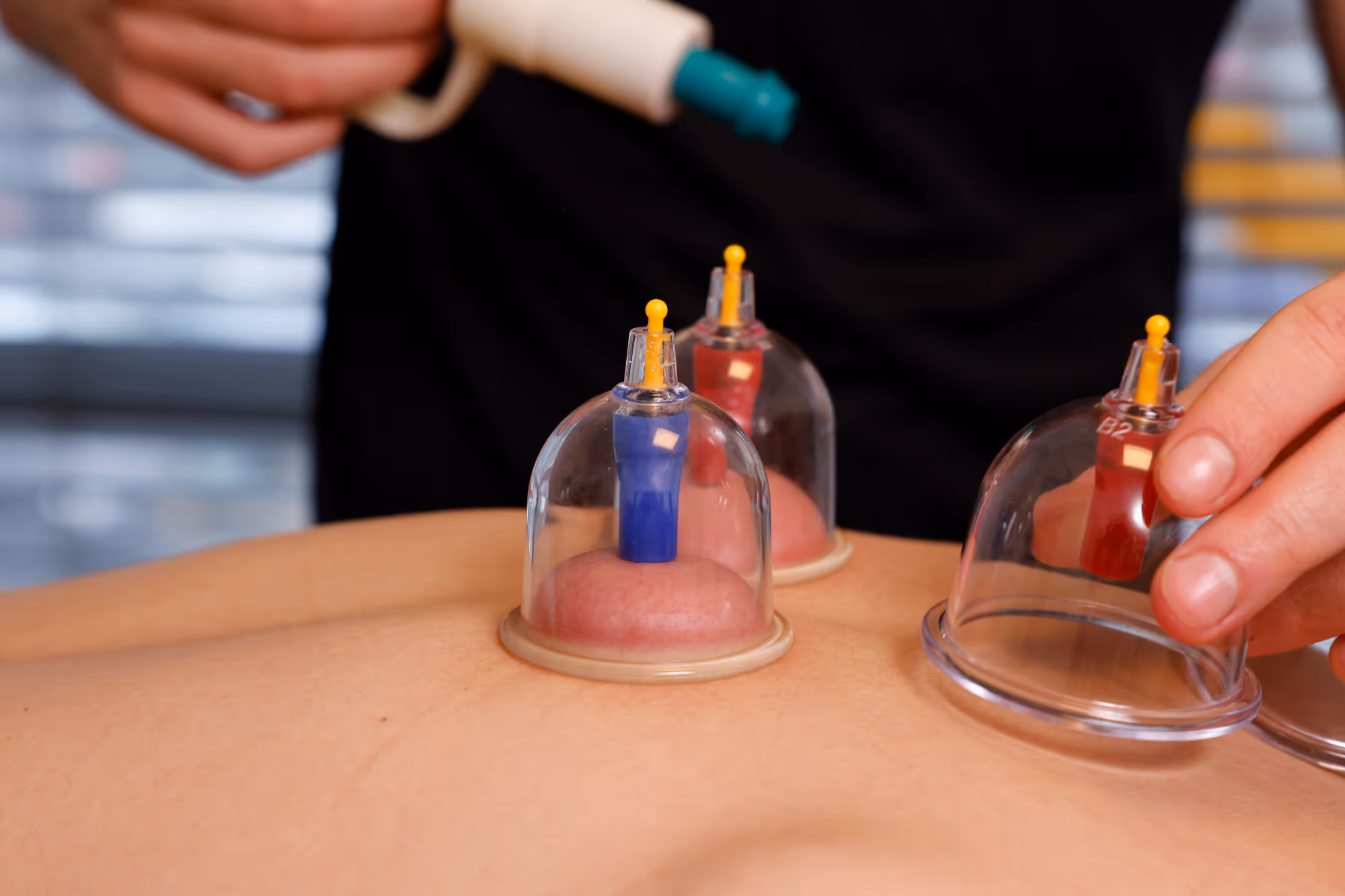 Voor wie is fasciatherapie geschikt?