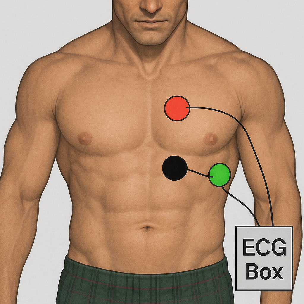 Three ECG electrodes placed on the patient's chest for cardiac gating at 1.5 T.