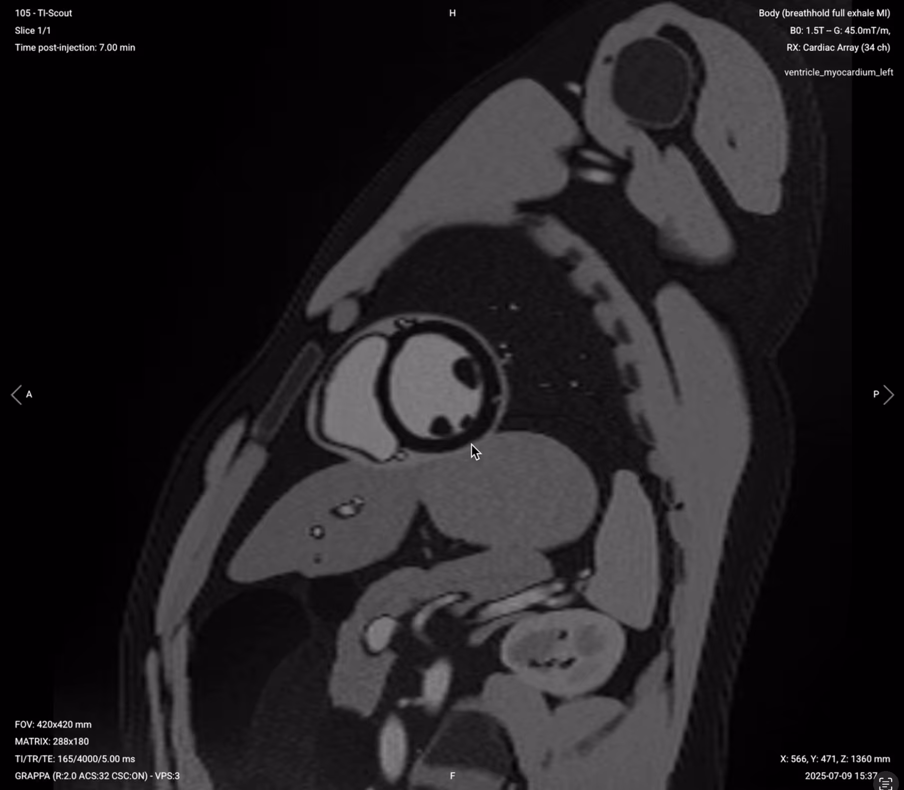 TI Scout – Correct Image Example