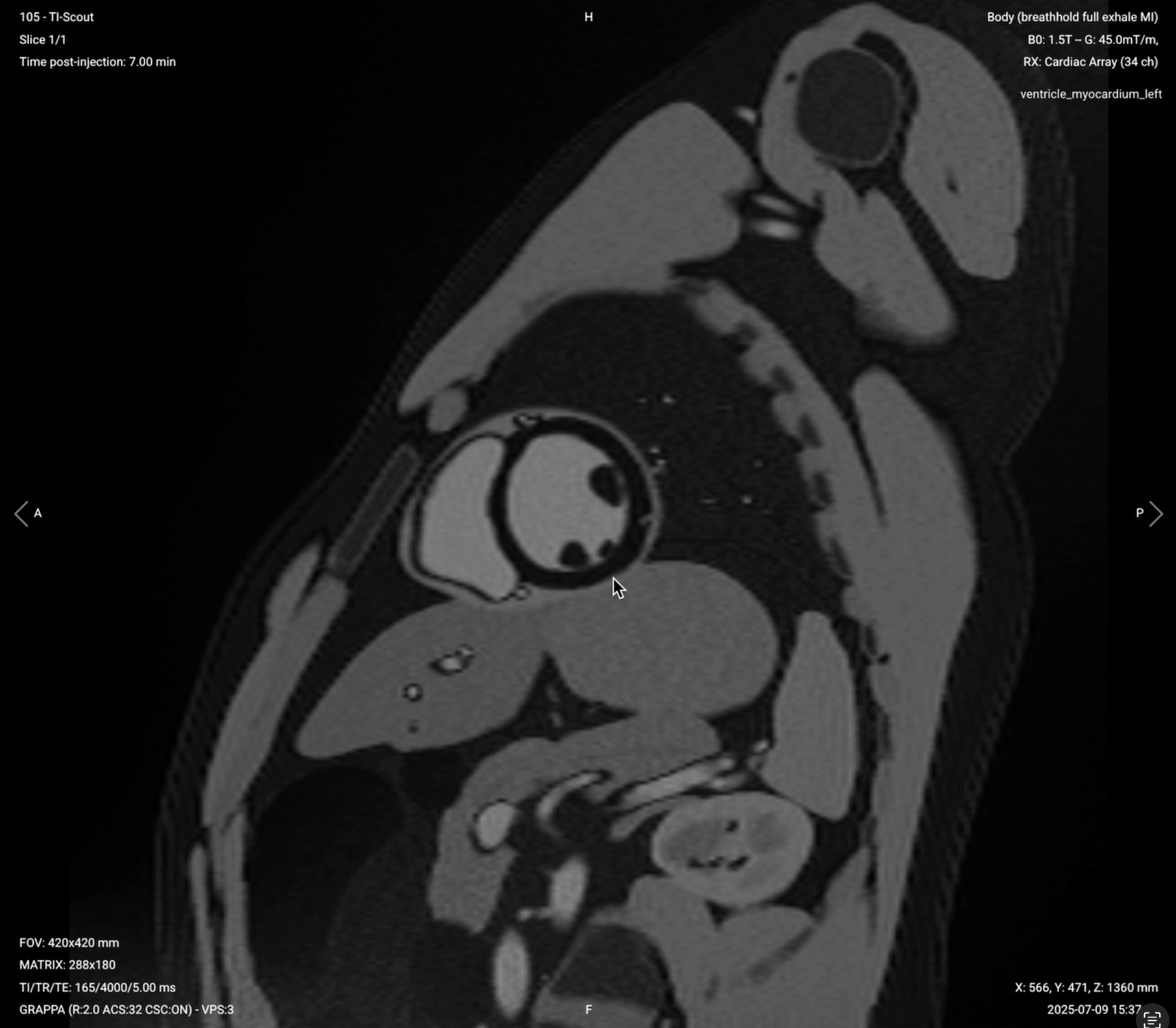 TI Scout – Correct Image Example