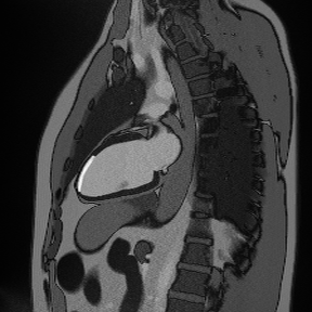 2-Chamber LGE – Correct Image Example