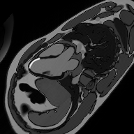 3-Chamber LGE – Correct Image Example
