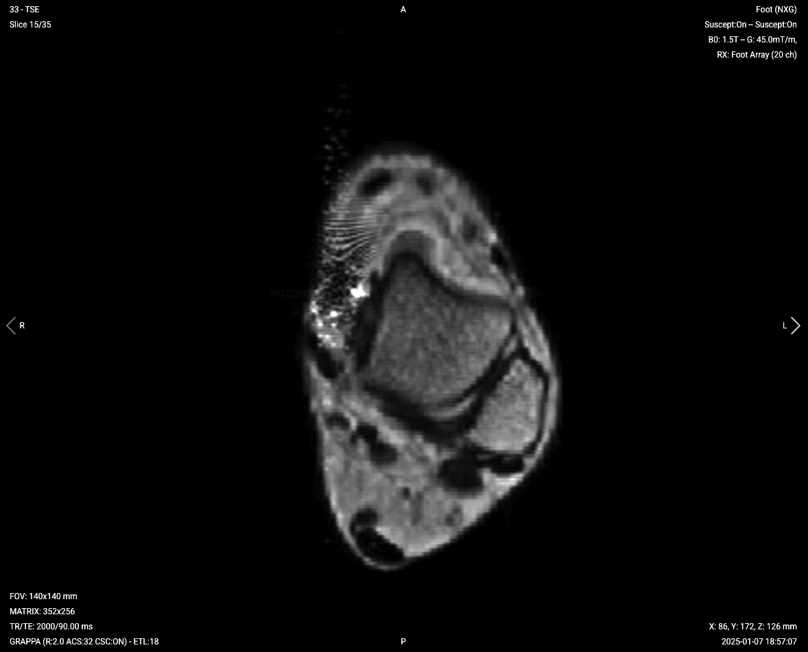 Axial T2 TSE – Correct Image Example