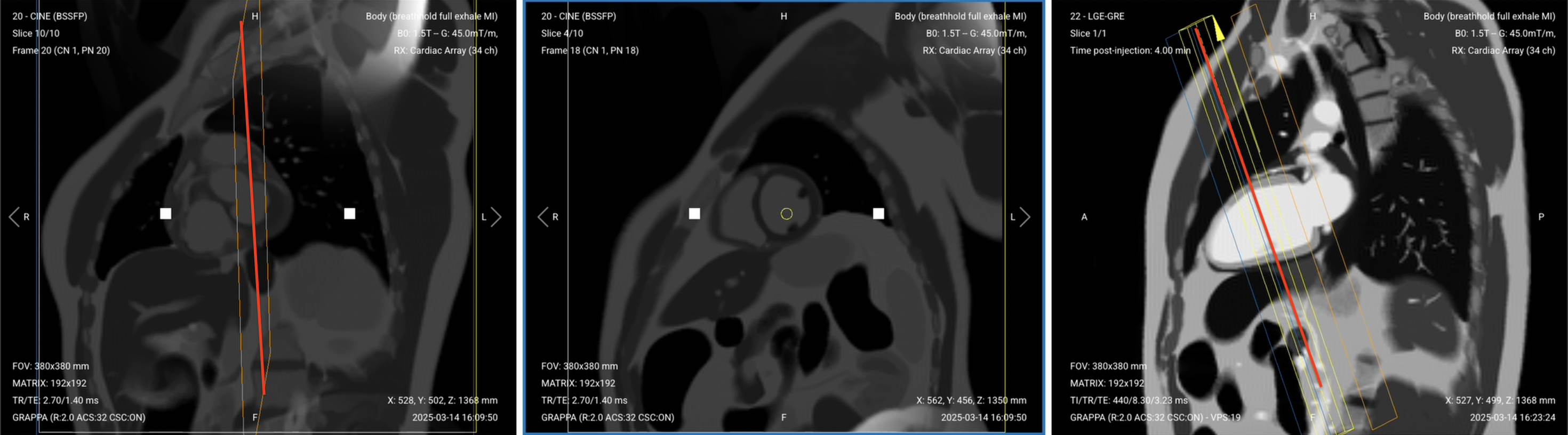 Correct Planning – TI Scout