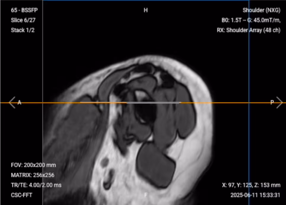 Sagittal Localizer – Correct Image Example