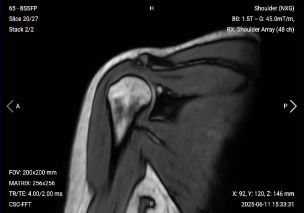 Coronal Localizer – Correct Image Example