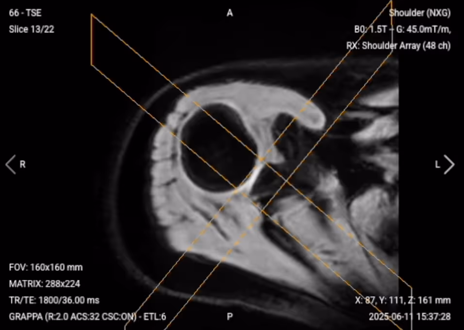 Axial PD Fat-Sat Localizer – Correct Image Example