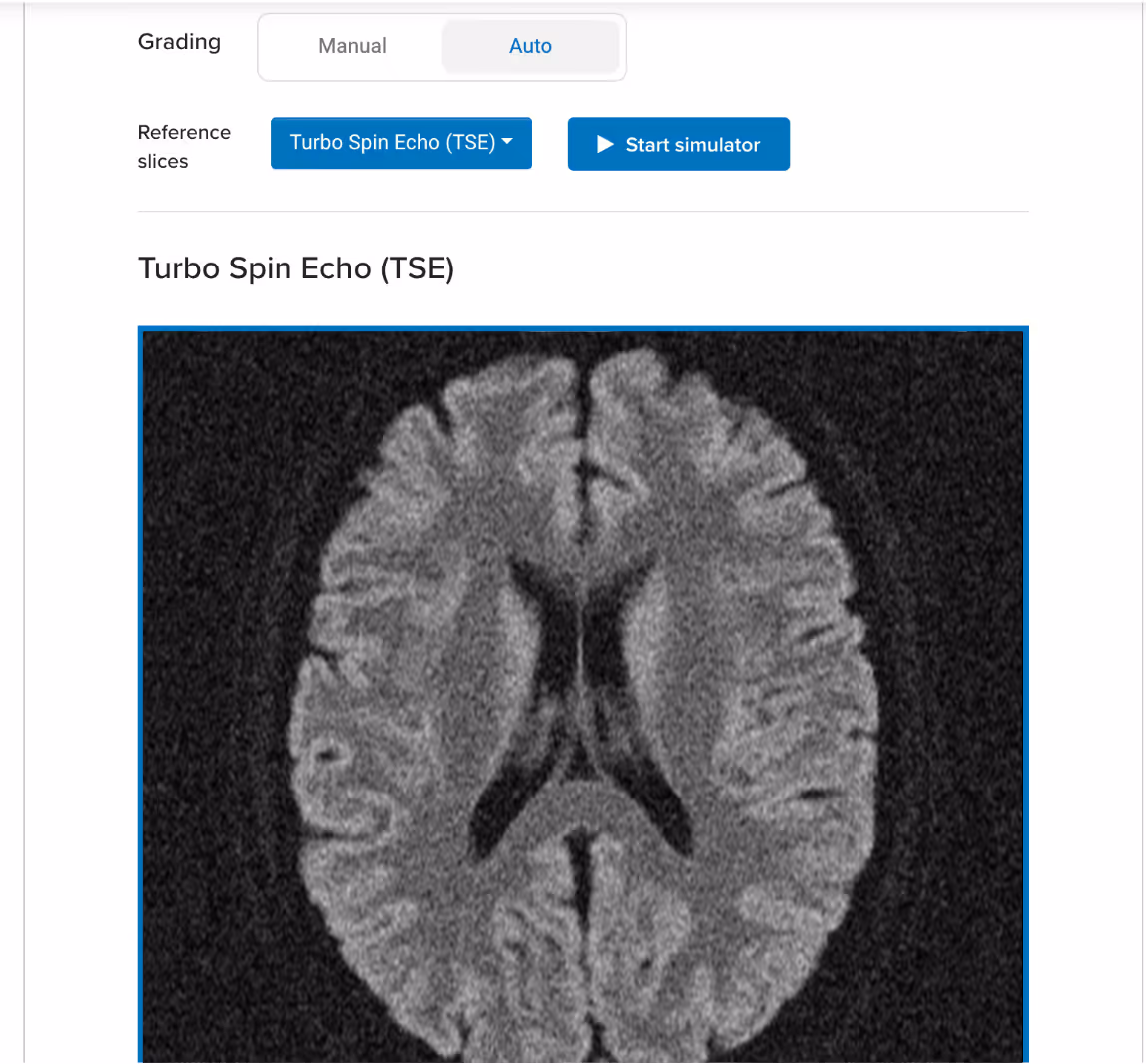 Corsmed UI: a scan assignment block that uses auto-grading, teacher has uploaded an axial T2 TSE of a brain as reference image