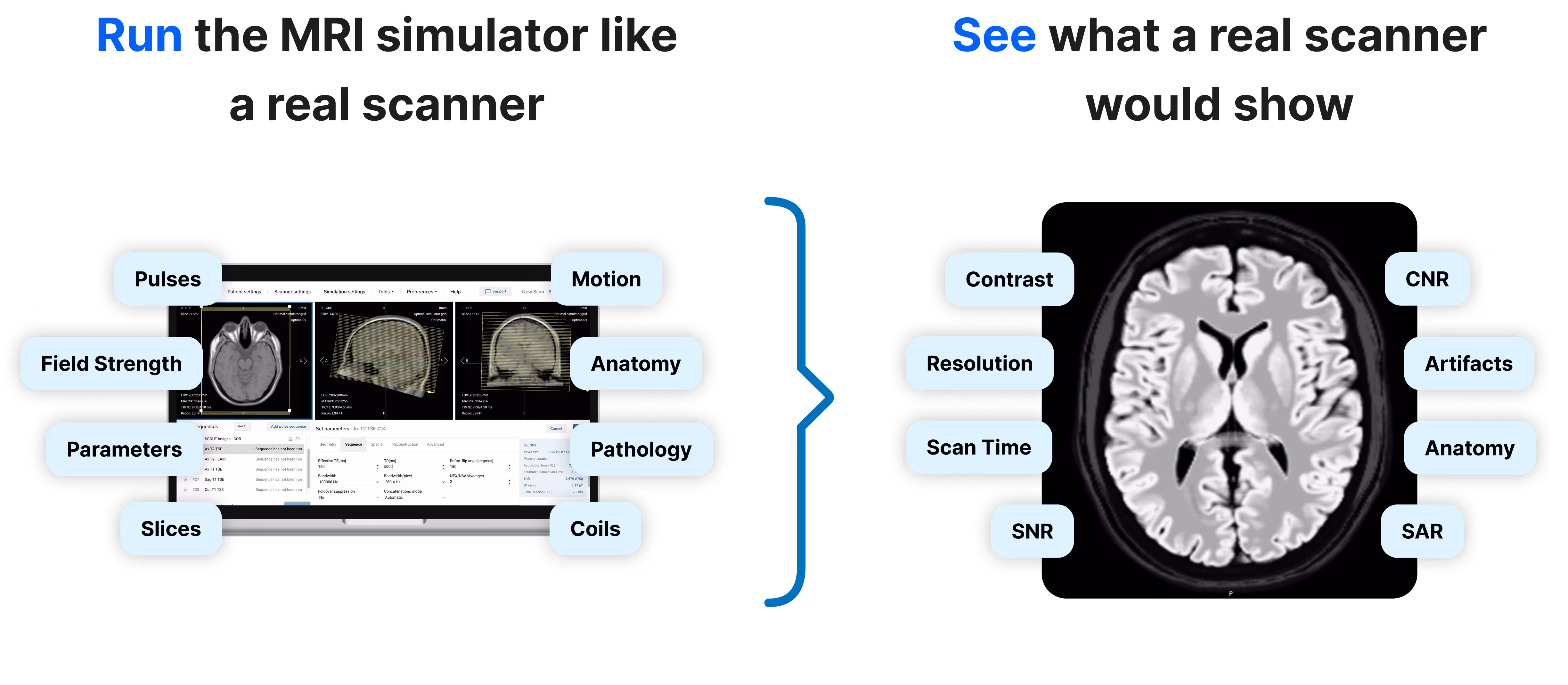 Comparison of Corsmed MRI simulator and real scanner outputs. Left side shows simulator interface with adjustable settings like pulses, field strength, parameters, slices, motion, anatomy, pathology, and coils. Right side shows resulting brain scan image with factors such as contrast, resolution, scan time, SNR, CNR, artifacts, anatomy, and SAR.