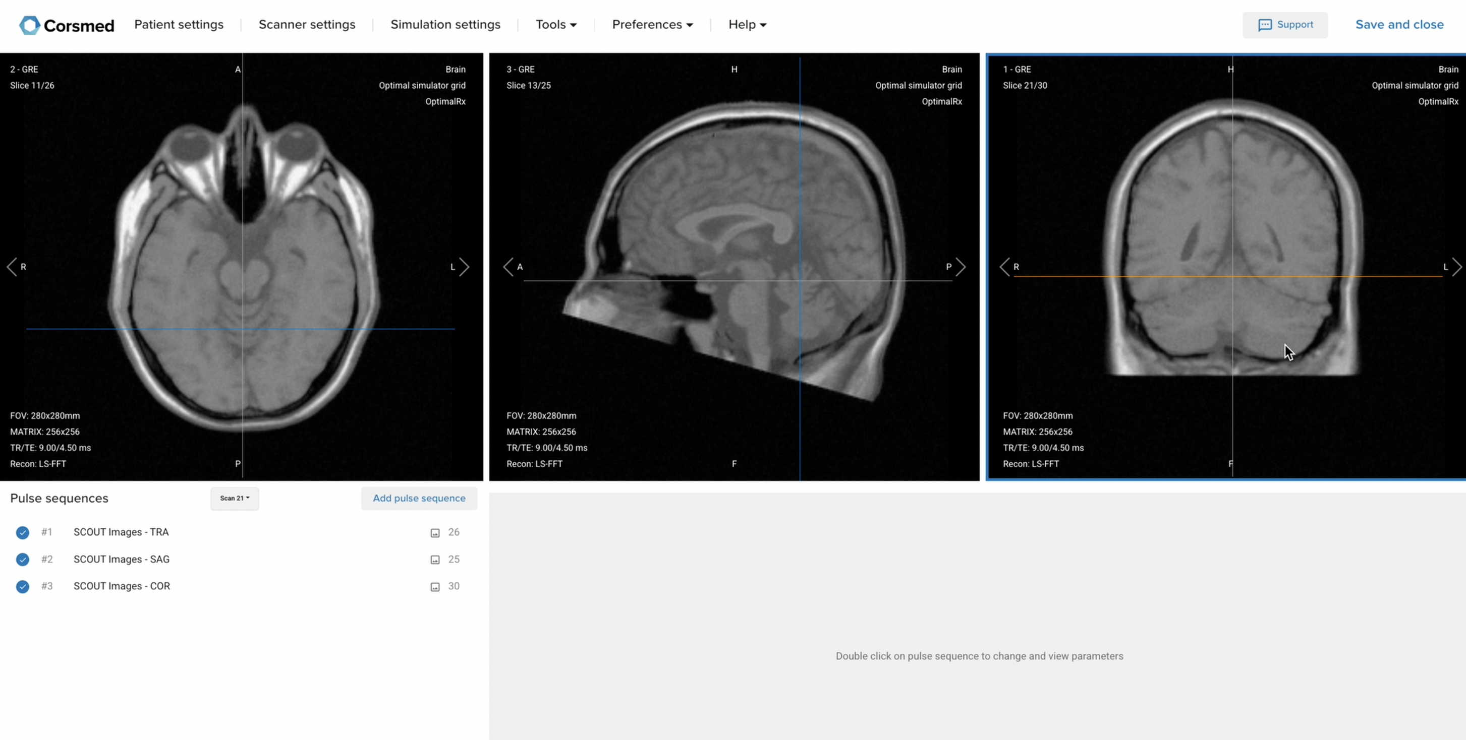 Correct setup of localizer images for brain tumor MRI
