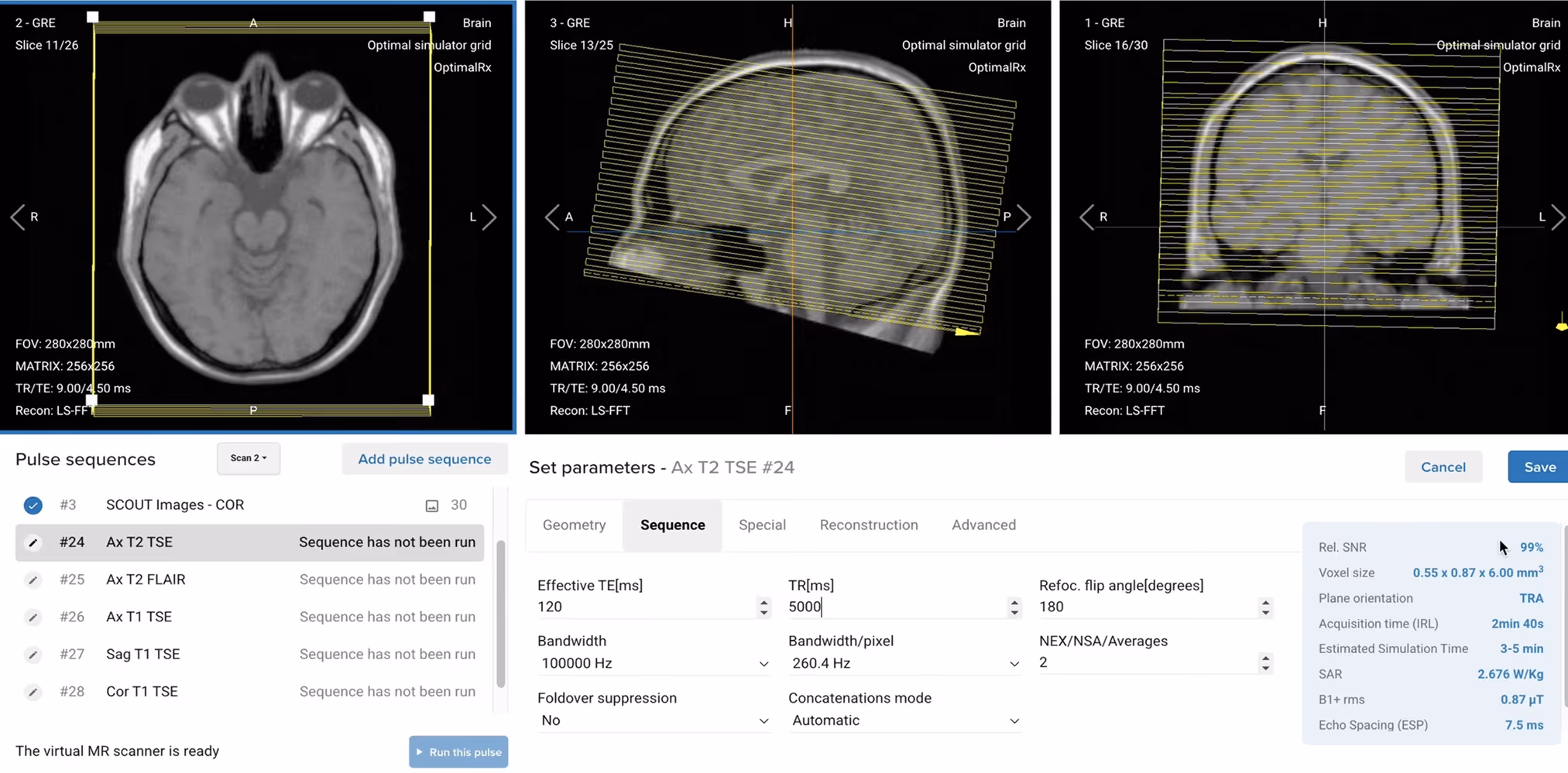 Brain slice planning on an MRI simulator