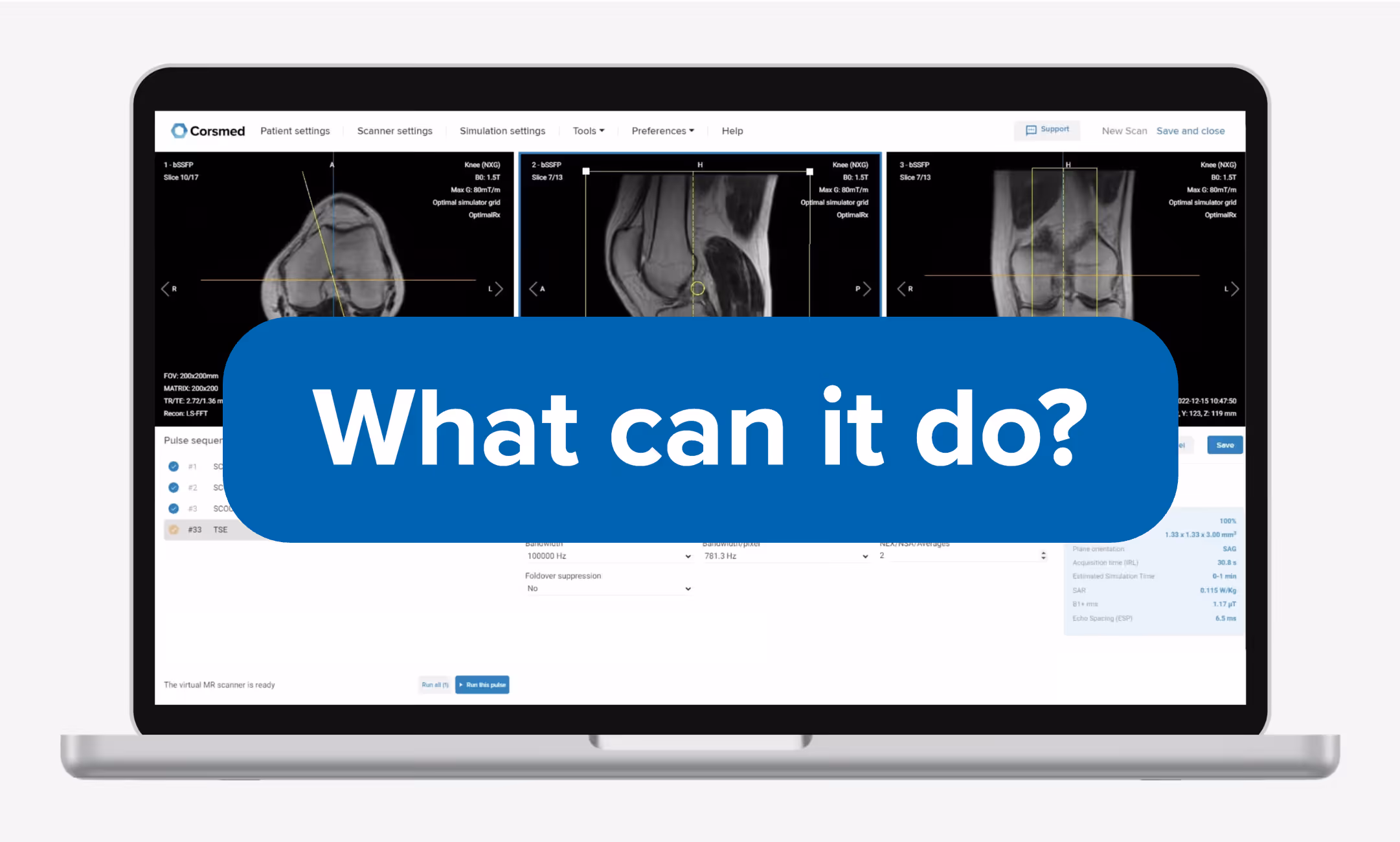 Corsmed MRI Simulator