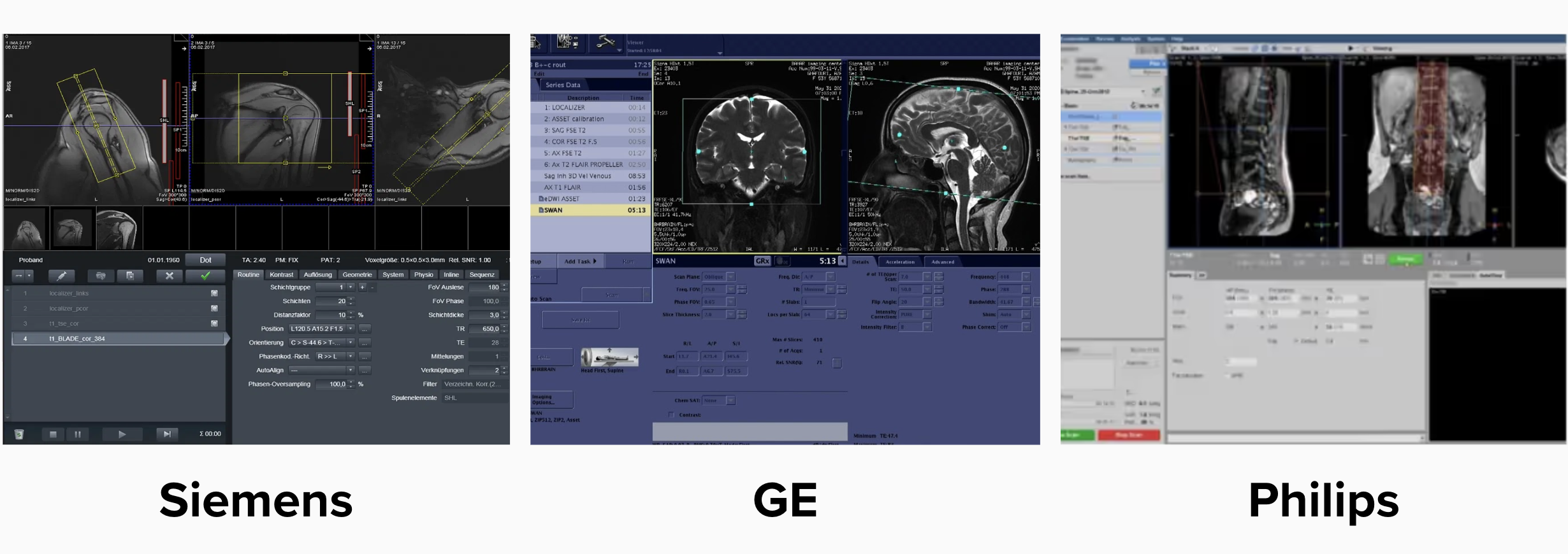 Interfaces of different MRI scanner brands: Siemens, GE, and Philips