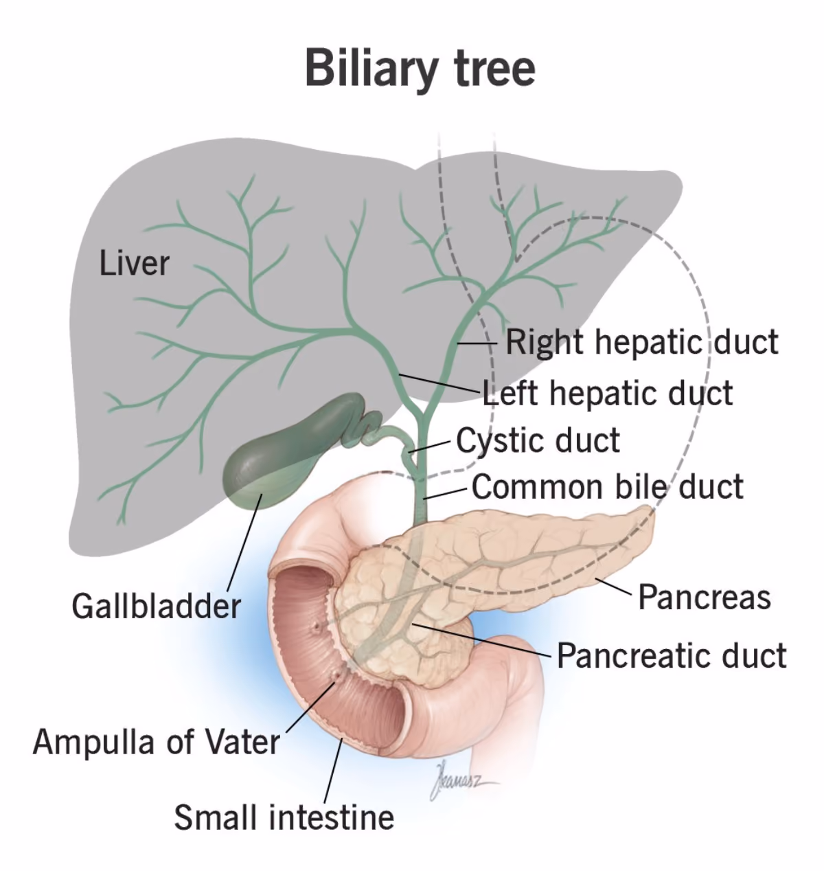Illustration of the biliary tree showing intrahepatic ducts, hepatic ducts, common hepatic duct, cystic duct, gallbladder, common bile duct, main pancreatic duct, and ampulla of Vater