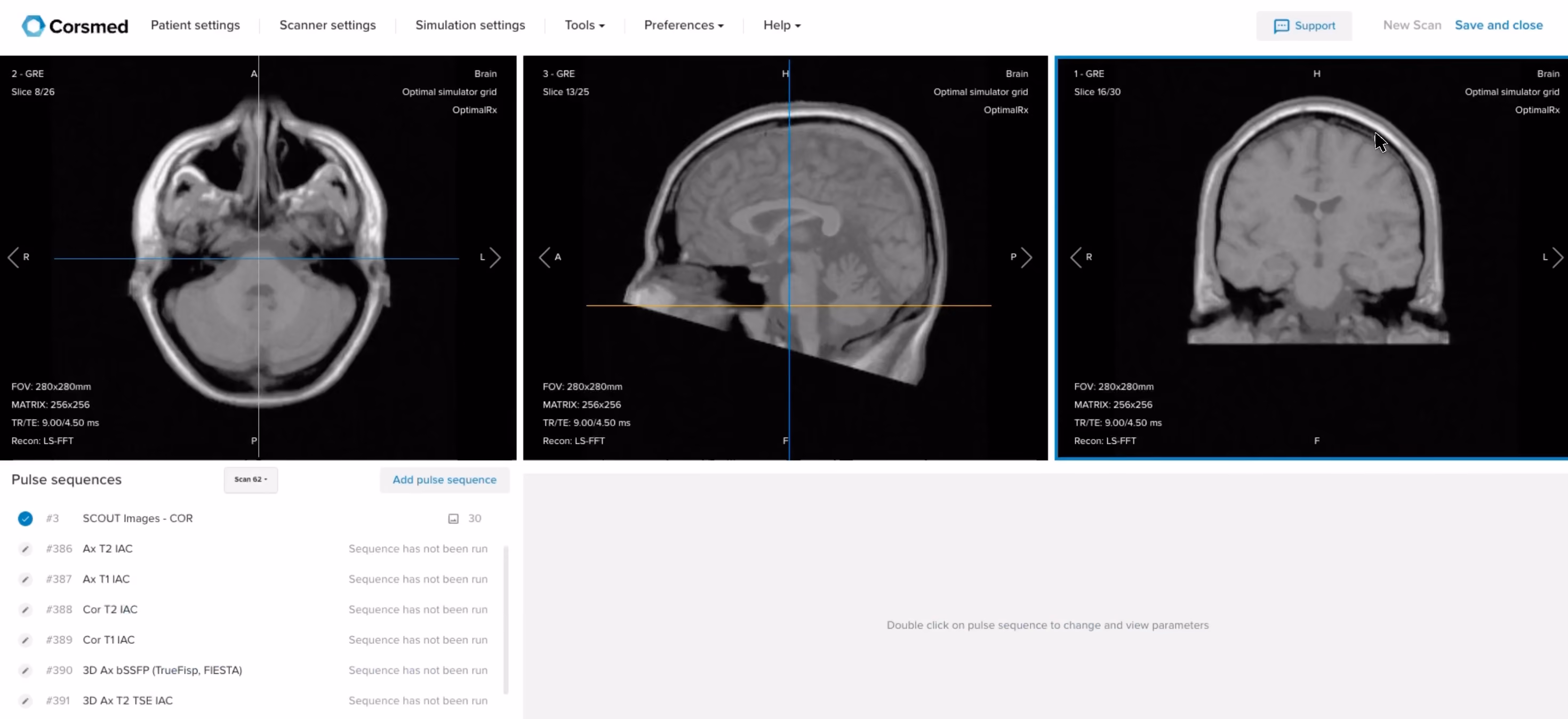 Correct setup of localizer images in the three viewports on the Corsmed MRI simulator
