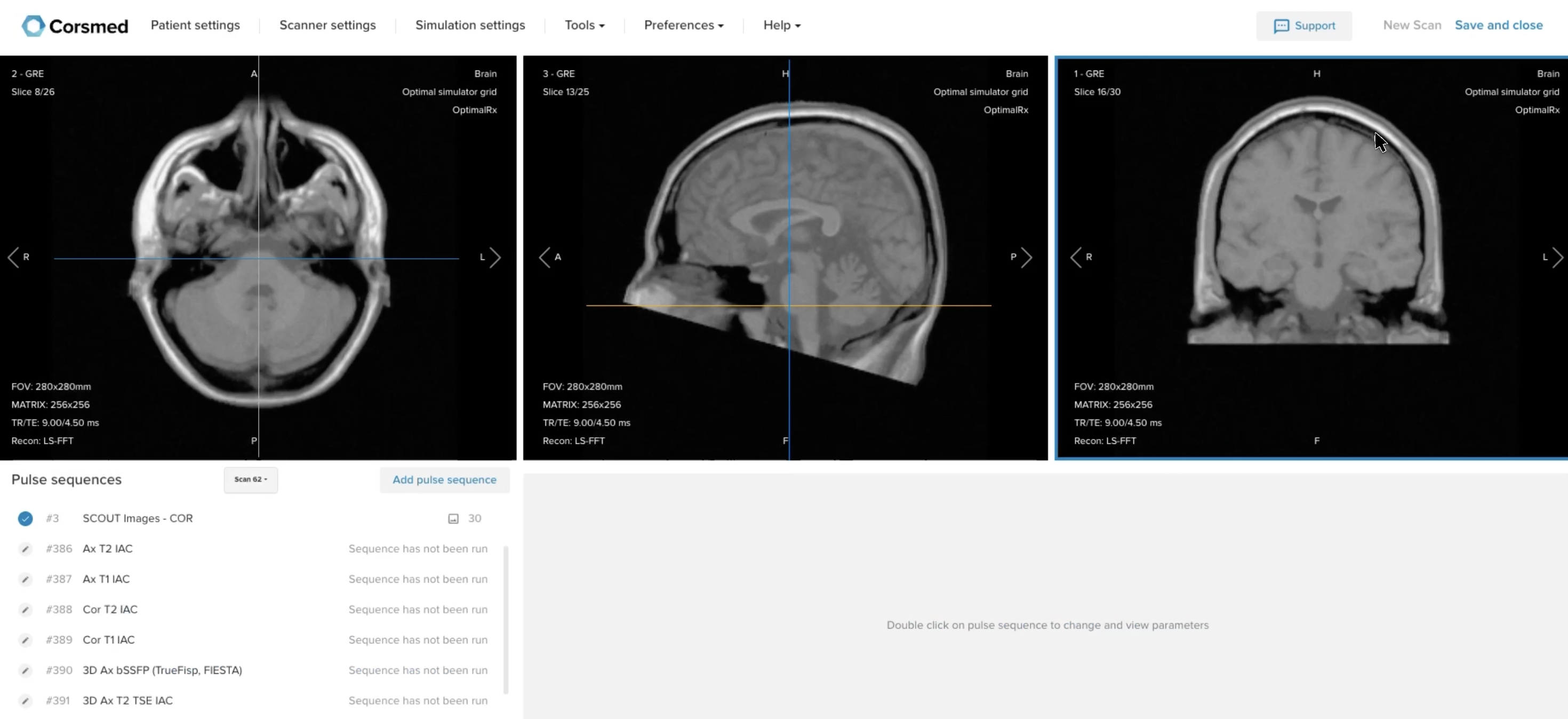 Correct setup of localizer images in the three viewports on the Corsmed MRI simulator