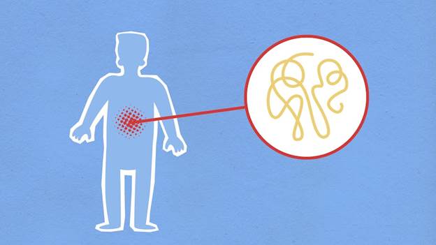Creative illustration depicting a stomach infection with a focus on viral pathogens.